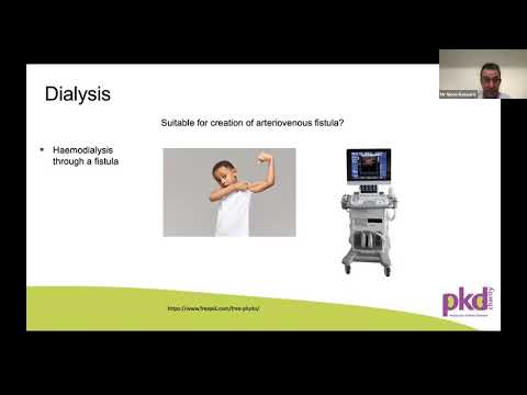 Video: ARPKD: Dialysis and Transplantation issues - Mr Nicos Kessaris, Consultant Transplant Surgeon