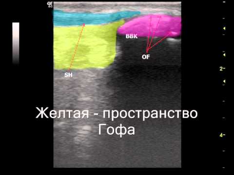 Как избавиться от симптомов шейного остеохондроза Удаление межпозвонковой грыжи в ростове на дону