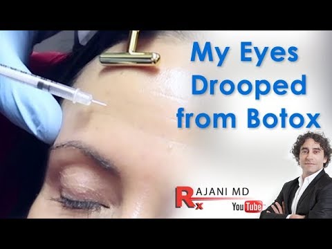 Naiwala ng tao ang may edad Payo Reduxine doktor