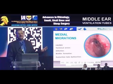 Myringotomy Surgery & Middle Ear Ventilation Tubes