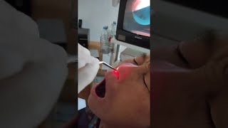 faze tari foarte scarbos