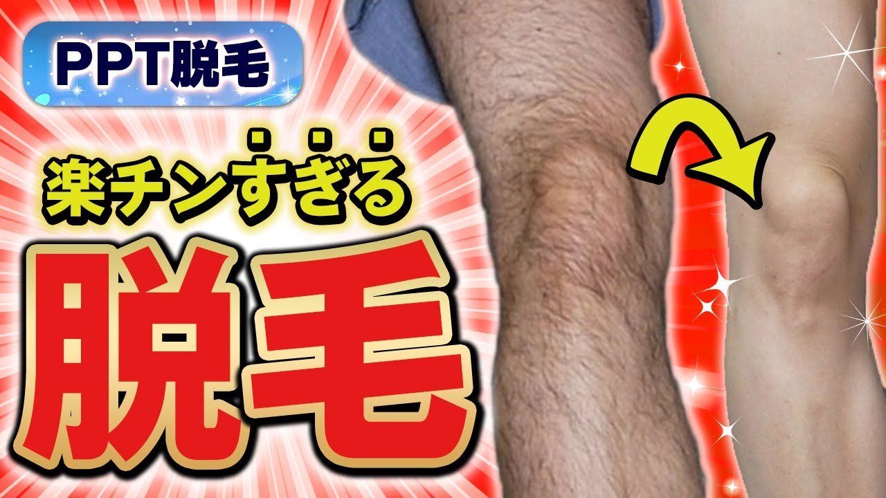【完全公開】世界で2番目にカンタンな元剛毛な男の脱毛ルーティン
