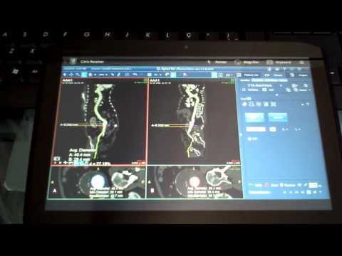 download lagu mp3 mp4 Terarecon Intuition, download lagu Terarecon Intuition gratis, unduh video klip Terarecon Intuition