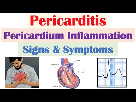 Introduction to ECG The Basics ECG Paper PQRST wave Rate Rhythm Axis and Interval