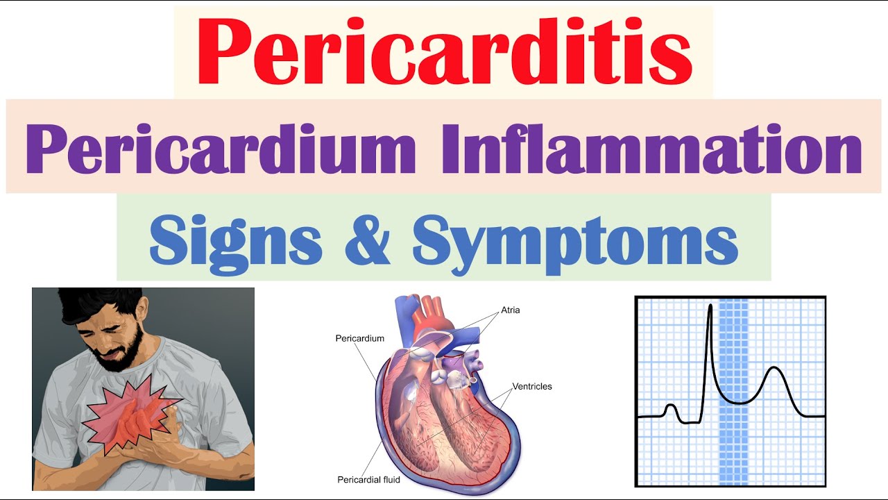 Pericarditis (Pericardial Inflammation) Signs & Symptoms (& Why They Occur)