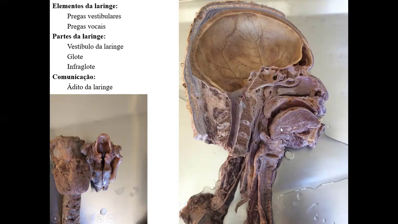 VÍDEO AULA SISTEMA RESPIRATÓRIO PARTE 2 - VIA AÉREA INFERIOR