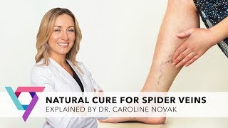 Medical Center: Natural Cure for Varicose Veins | Top Vein Expert New York 10016