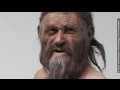 An Iceman S Upset Stomach Can Teach Us About The Earliest Europeans Newsy
