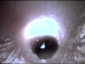 Sperm Duct Inside