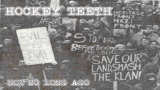 HOCKEY TEETH - NOT SO LONG AGO