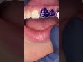 Color Correcting Purple ToothPaste Does It Work