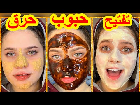 ماسكات من المطبخ جابت نتيجة للتفتيح وازالة الحبوب???? جربت ماسك جديدحرق وشى????تفتيح الاماكن الحساسه هنا hana