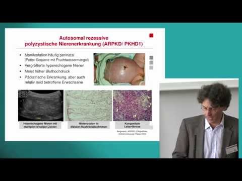 Meine Zystennieren (ADPKD) - Genetische Grundlagen