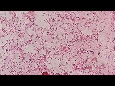 gram -ve bacilli