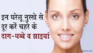 Home Remedies For Face Spots and Freckles in Hindi | इन घरेलू नुस्खे से दूर करें चहरे के दाग-धब्बे व झाइयां