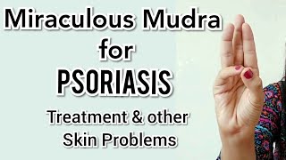 Yoga Mudra for Psoriasis problems | Mudra for Skin dryness