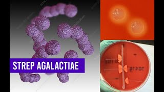 Streptococcus  Agalactiae Bacteria | Complete Overview