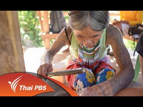 ภูมิแพ้ผิวหนังอักเสบ Neocate ความคิดเห็น โรคผิวหนังภูมิแพ้เปิดเผย