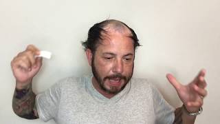 What to expect out of a Stock Hair Replacement or Hair System