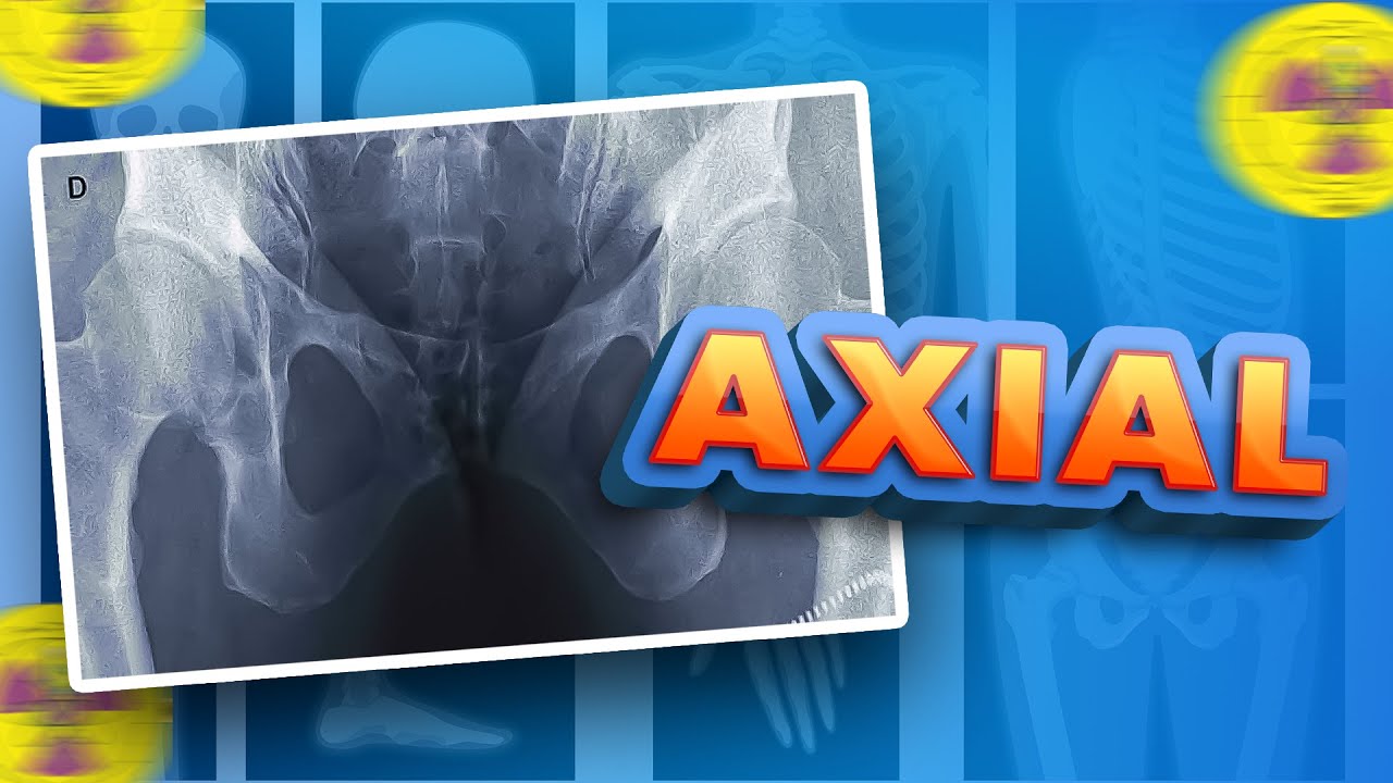 WHAT IS AN AXIAL INCIDENCE | Radiologizing