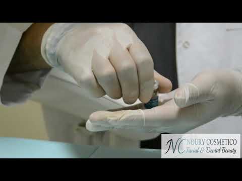 Neurotoxin Reconstitution  - Dr. Noury Adel