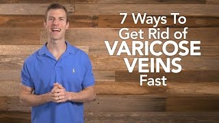 7 Ways to Get Rid of Varicose Veins Fast
