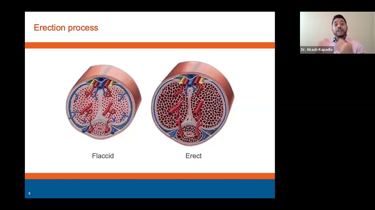 Men's Health Awareness Webinar | Tackling Erectile Dysfunction with Dr. Akash Kapadia