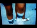 Knees