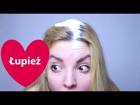 Hiperandrogenizm wypadanie włosów Jak leczyć robaki włosów