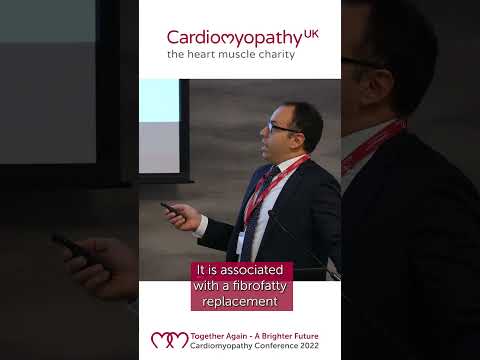What is Arrhythmogenic Cardiomyopathy (ACM)?