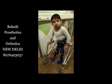 Legs rebuilt paralysis splint hip knee ankle foot orthosis