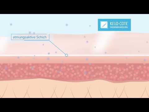 So wirkt KELO-COTE® | Für ein schönes Narbenbild
