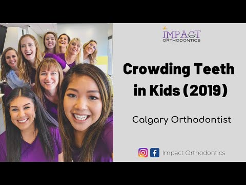 Crowded Teeth In Kids | Calgary Orthodontist Can Fix It
