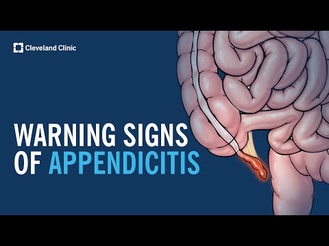 Warning Signs of Appendicitis