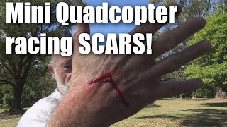 Racing Drone draws blood