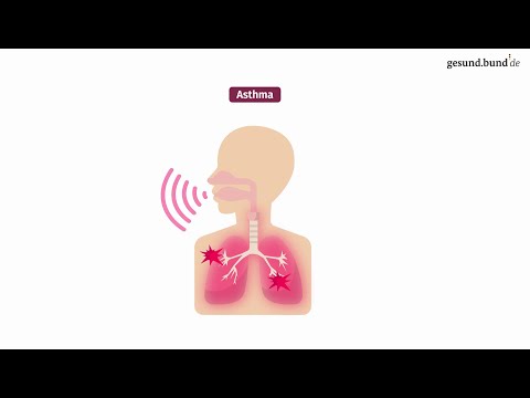 What is asthma?