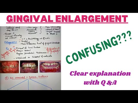 For those who feel all the gingival enlargements look same…(clarify all your doubts)