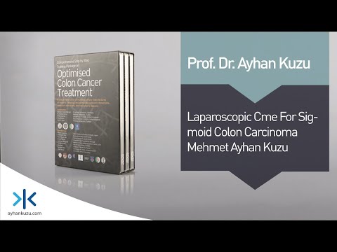 3.1.2. Laparoscopic CME for Sigmoid Carcinoma - M. Ayhan Kuzu