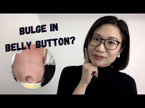 Umbilical Hernia: Worried about a bulge in baby's belly button and What to do? | Dr. Kristine Kiat