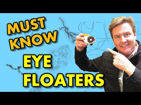 What your EYE DOCTOR hasn't TOLD you:  EYE FLOATERS EXPLAINED