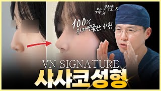 무보형물코성형 브이엔 시그니처 샤샤코 (연골입자,비개방코성형)