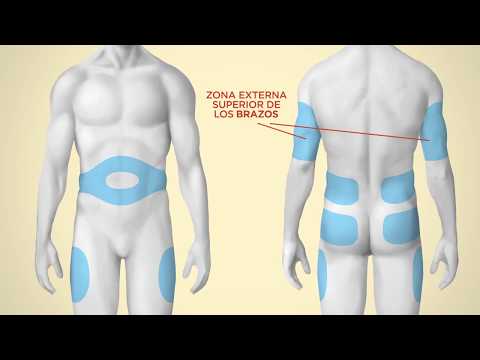Técnica de administración de insulina con jeringas