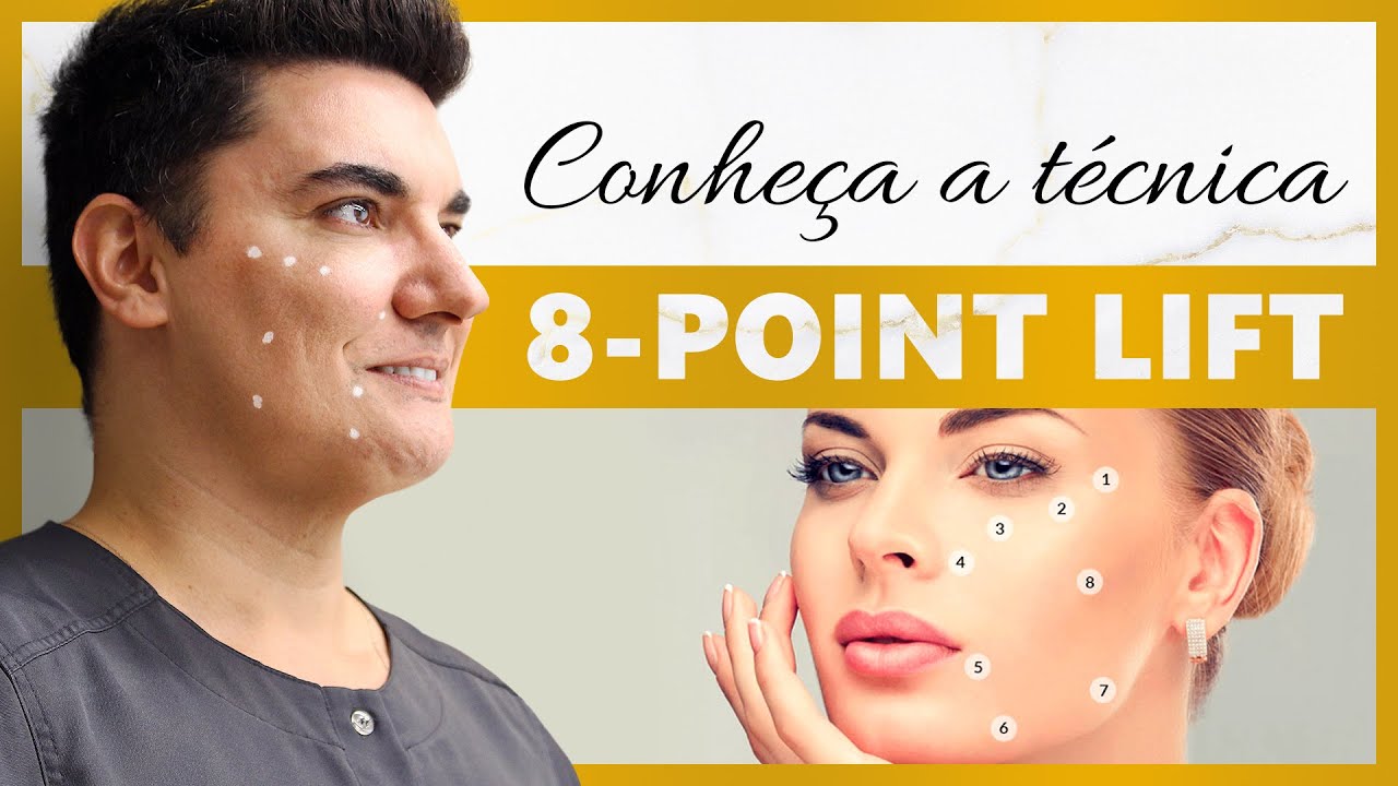 Harmonização facial com 8-Point Lift: Que Técnica é essa? #mdcodes