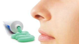 how make nose smaller without surgery