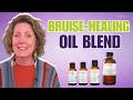 How to Heal Bruises FAST with This Powerful Essential Oil Blend!