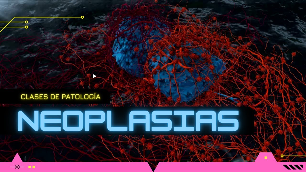 Neoplasias, curso 2022A