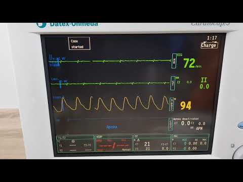 Datex-Ohmeda Cardiocap/5 Patient Monitor