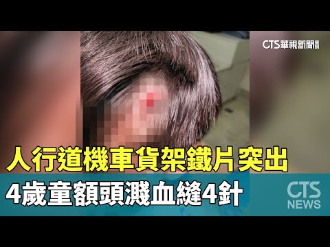 人行道機車貨架鐵片突出　4歲童額頭濺血縫4針
