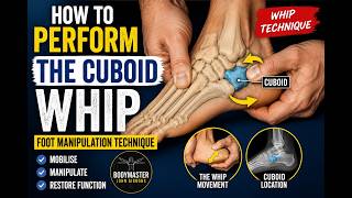 How to Mobilise & Manipulate the Cuboid Bone (Whip technique)