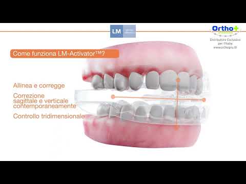 LM Activator - Video 2022